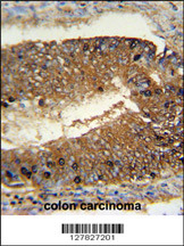 NSUN7 Antibody (C-term)