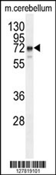 ZNF595 Antibody (C-term)