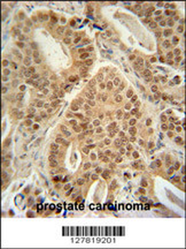 ZNF595 Antibody (C-term)