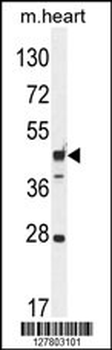 RILPL1 Antibody (C-term)