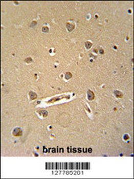 DENND5B Antibody (C-term)