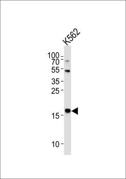NAT14 Antibody (N-term)