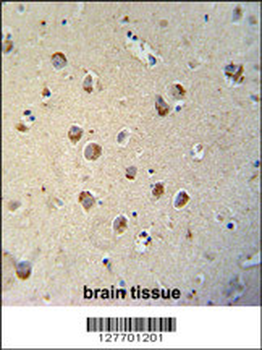 TECTB Antibody (N-term)