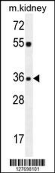 KLF14 Antibody (C-term)