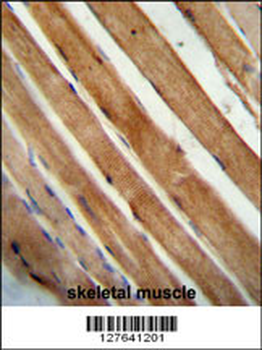 SLC25A12 Antibody (N-Term)