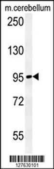 NAA25 Antibody (Center)