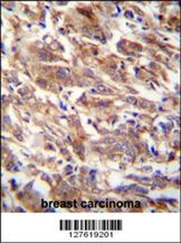 FBXW12 Antibody (C-term)