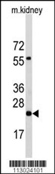 PEMT Antibody (N-term)