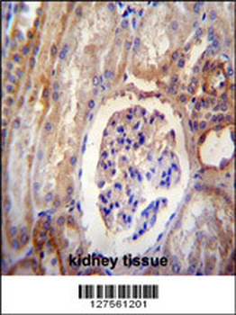 DYNLRB2 Antibody (Center)