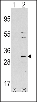 NNMT Antibody (Center)