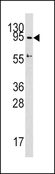 Dnmt3A/Dnmt3A2 Antibody (C-term)