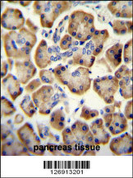 RADIL Antibody (C-term)
