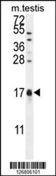 CAMK2N1 Antibody (C-term)
