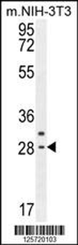 CLDN22 Antibody (Center)