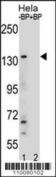 M JMJD3 Antibody (Center)