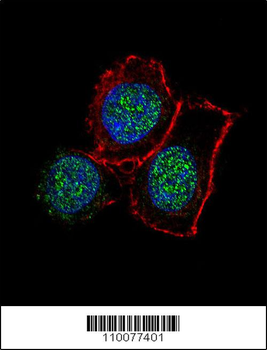 JMJD3 Antibody (N-term)