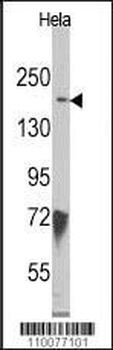 JMJD3 Antibody (N-term)