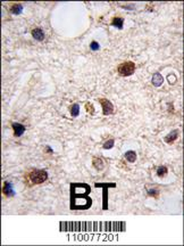 JMJD3 Antibody (N-term)