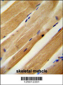 MLXIP Antibody (N-term)