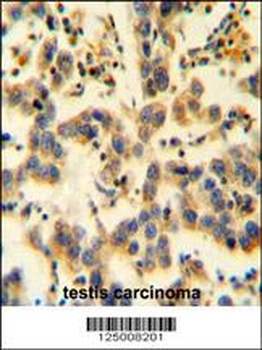 K0090 Antibody (C-term)