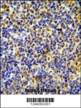 IKZF1 Antibody (C-term)