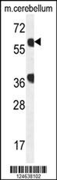 GTPBP2 Antibody (C-term)
