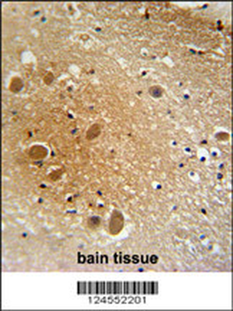 SPARCL1 Antibody (Center)