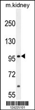 MED25 Antibody (N-term)