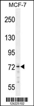 MED25 Antibody (N-term)