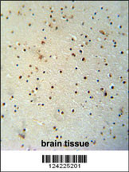MED25 Antibody (N-term)