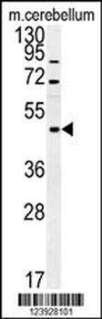 FUS Antibody (C-term)