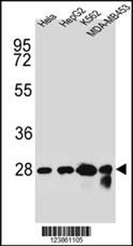 CHPT1 Antibody (N-term)