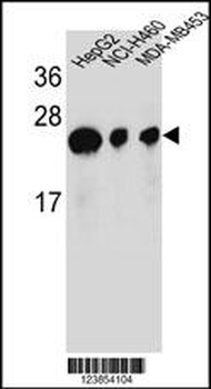 ATP5H Antibody (Center)