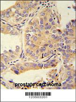 UBA52 Antibody (C-Term)