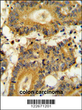 RPS6KA1 Antibody
