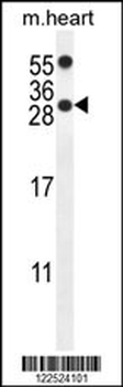 PP1R14C Antibody (C-term)