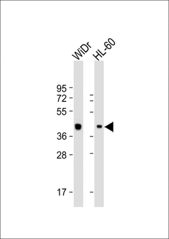 TFB2M Antibody (C-term)