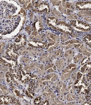 CCNY Antibody (Center)
