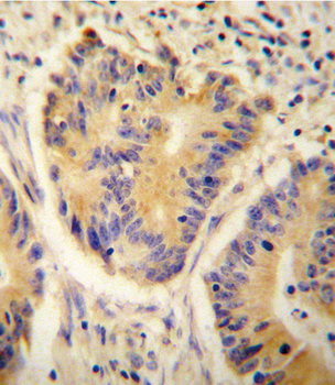 ADH4 Antibody (C-term)