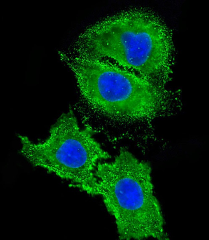 AGTR1 Antibody (Center)