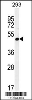 A4GALT Antibody (N-term)
