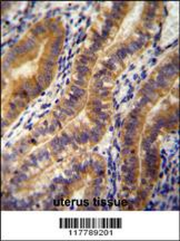 ANGPT2 Antibody (C-term)