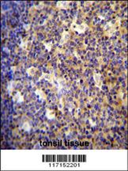ALOX12B Antibody (C-term)