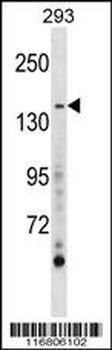 AEBP1 Antibody (Center)