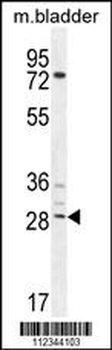 BCA3 Antibody (N-term)