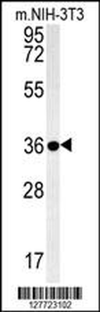 LGALS9B Antibody (Center)