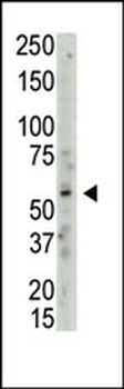 PRMT3 Antibody (C-term)