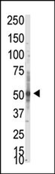PRMT3 Antibody (N-term)