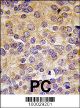 PRMT3 Antibody (N-term)