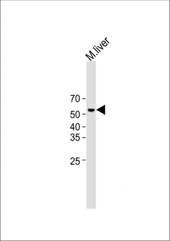 ZCCHC5 Antibody (N-term)